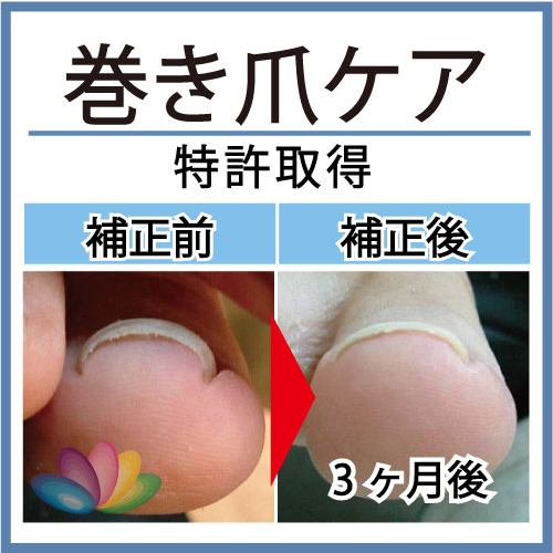 ダウンロード (3)